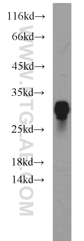 WB analysis of mouse brain using 55472-1-AP