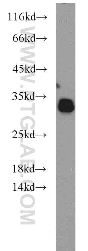 Western Blot (WB) analysis of human brain tissue using NPAS3 Polyclonal antibody (55472-1-AP)