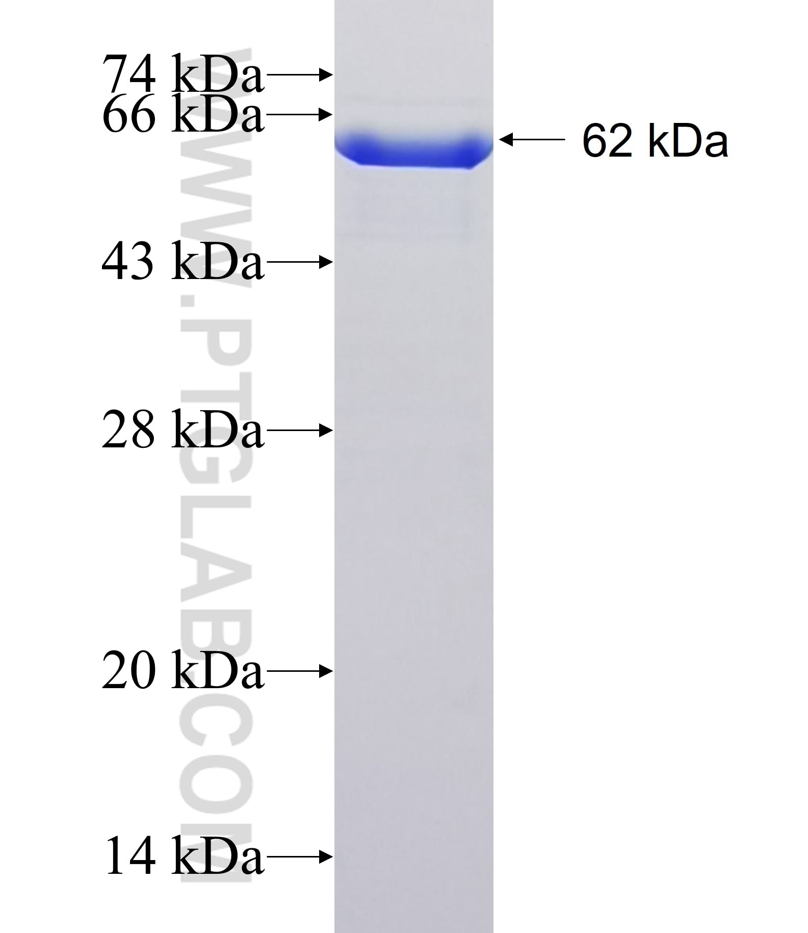NPAT fusion protein Ag34211 SDS-PAGE NPAT fusion protein Ag34211 SDS-PAGE