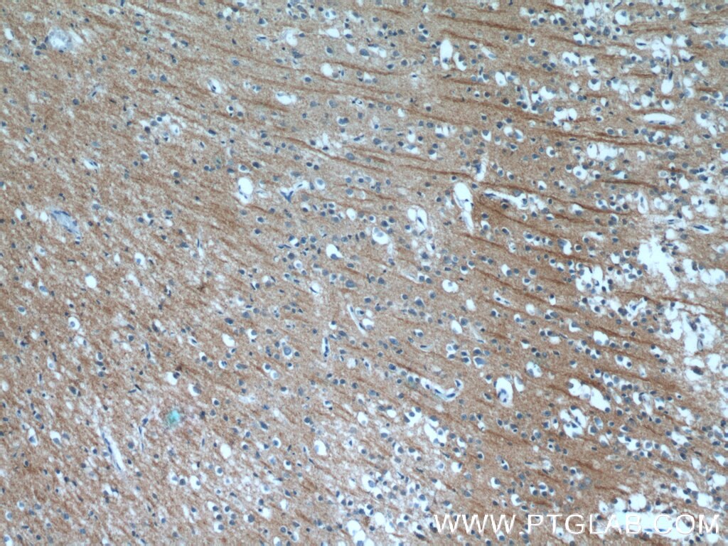 Immunohistochemistry (IHC) staining of human brain tissue using NPB Polyclonal antibody (25517-1-AP)