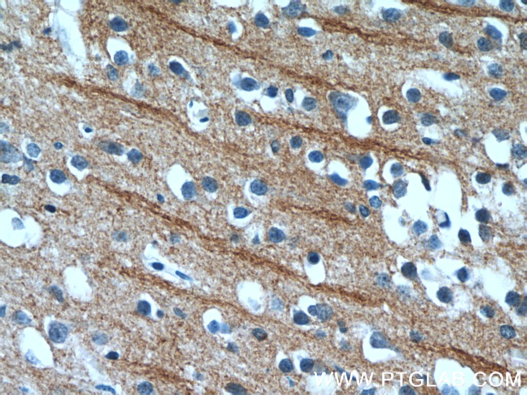 Immunohistochemistry (IHC) staining of human brain tissue using NPB Polyclonal antibody (25517-1-AP)