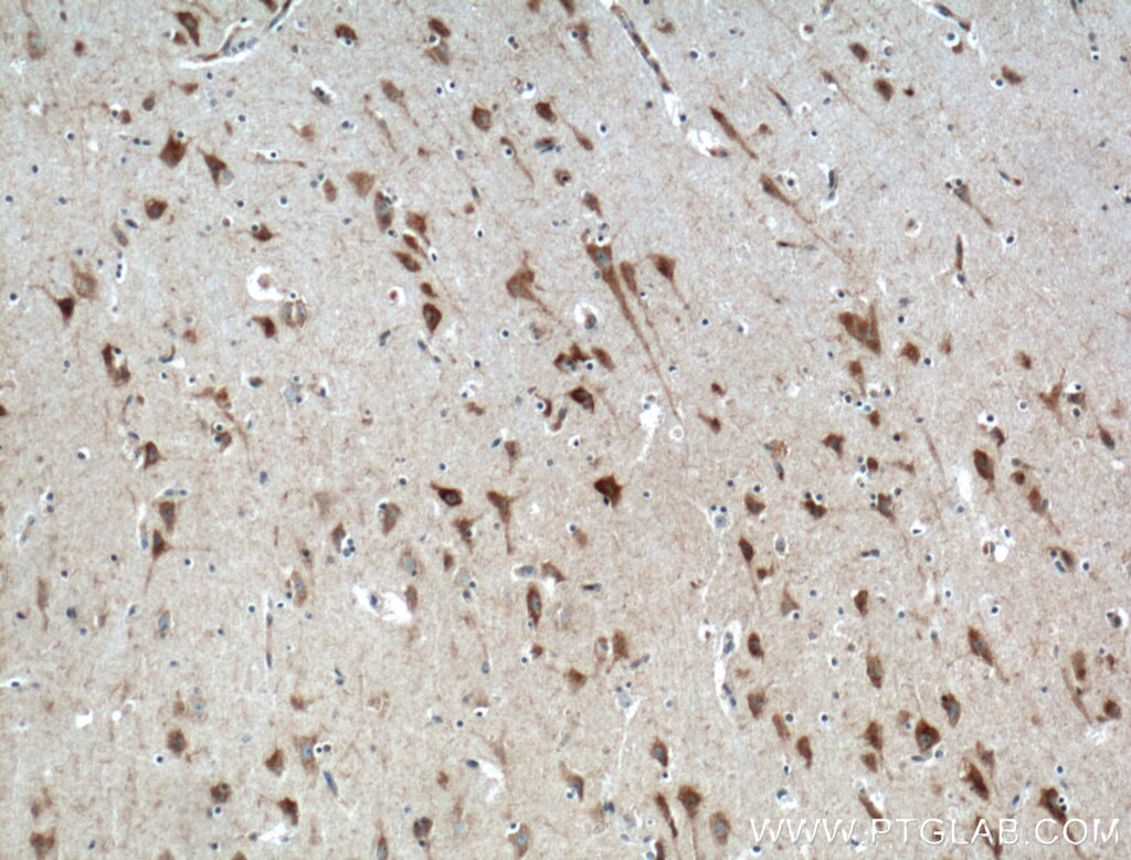 Immunohistochemistry (IHC) staining of human brain tissue using NPBWR1 Polyclonal antibody (24625-1-AP)