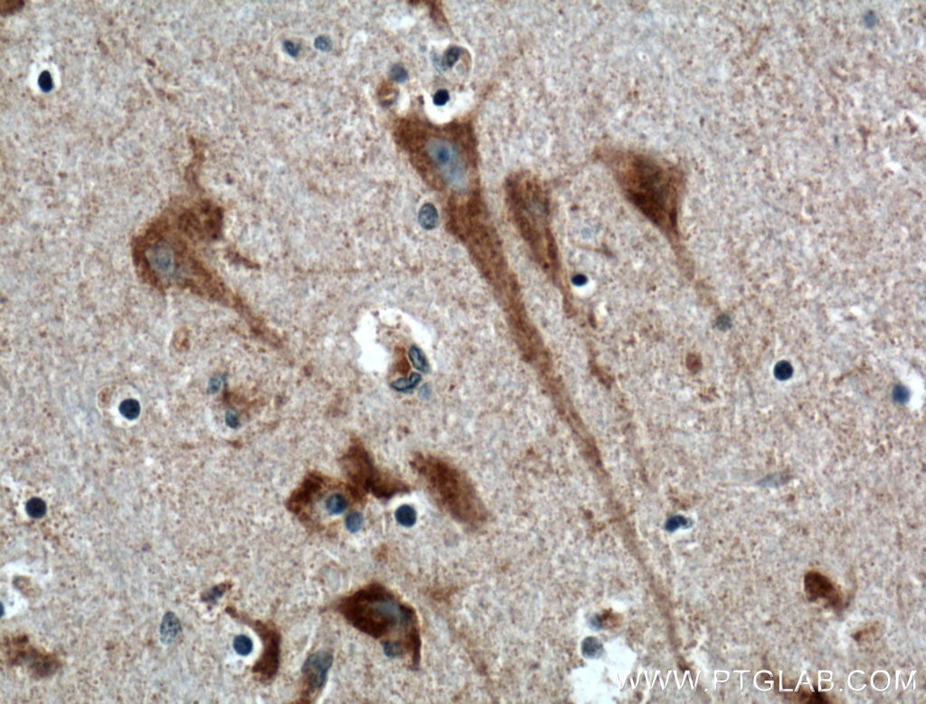 Immunohistochemistry (IHC) staining of human brain tissue using NPBWR1 Polyclonal antibody (24625-1-AP)