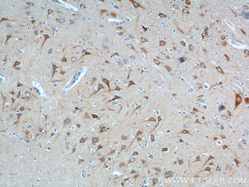 Immunohistochemistry (IHC) staining of human brain tissue using NPBWR2 Polyclonal antibody (24162-1-AP)