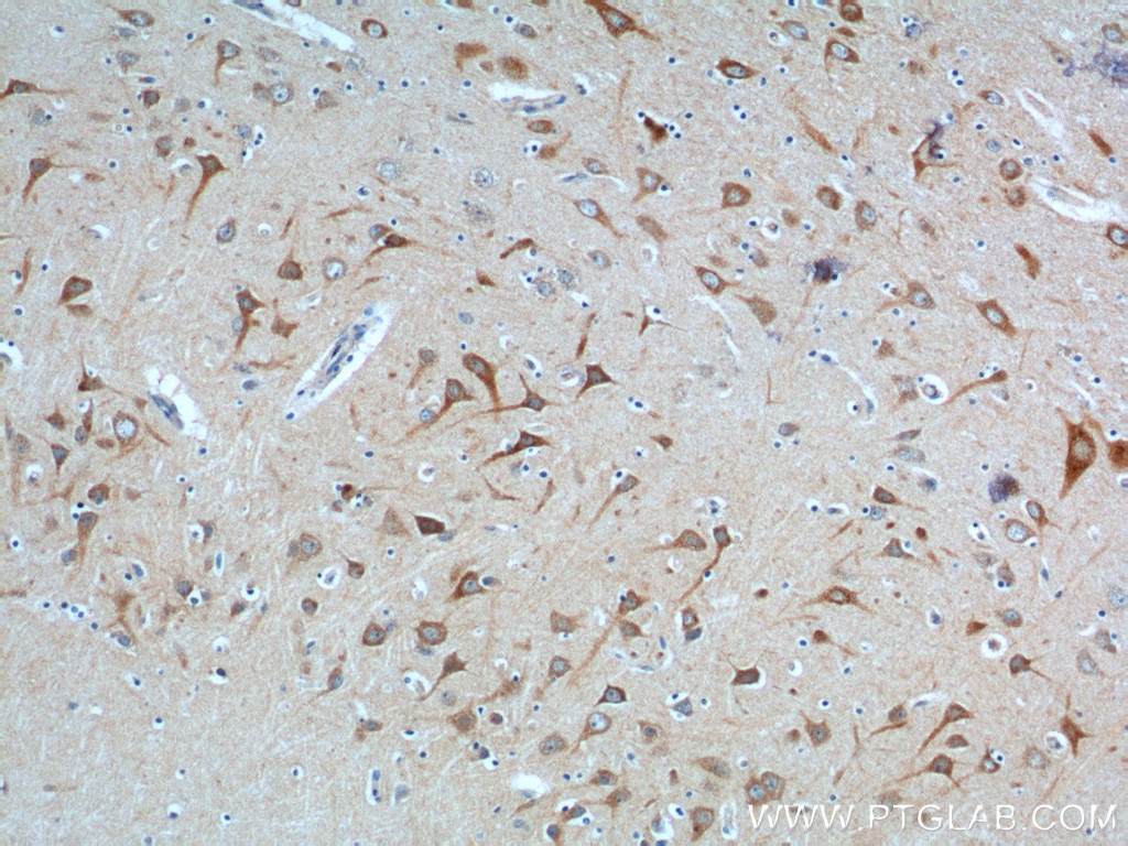 IHC staining of human brain using 24162-1-AP