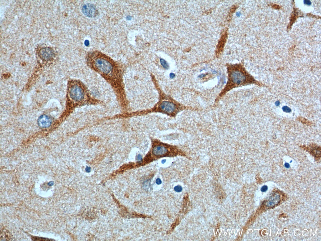 Immunohistochemistry (IHC) staining of human brain tissue using NPBWR2 Polyclonal antibody (24162-1-AP)