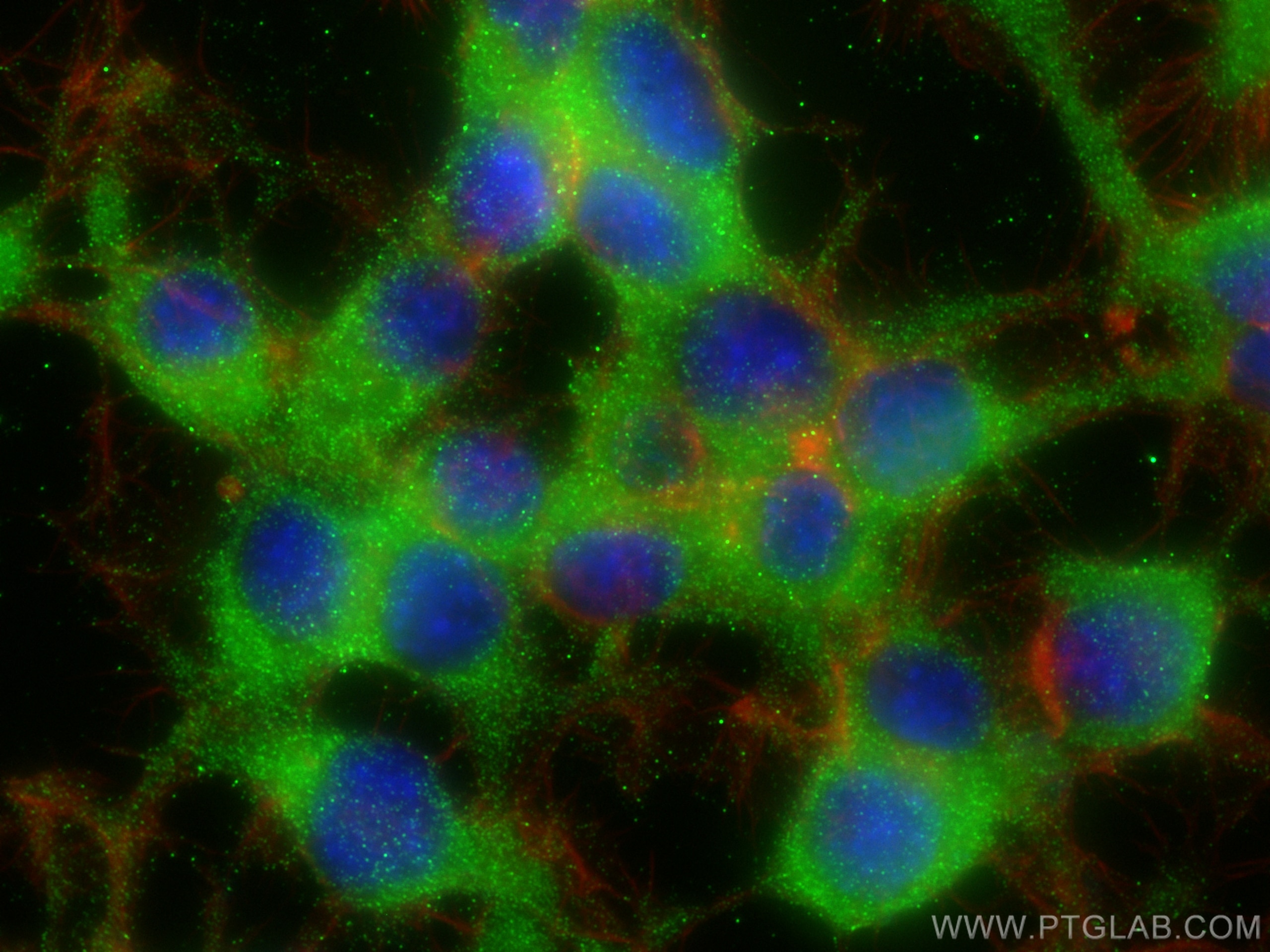 Immunofluorescence (IF) / fluorescent staining of Neuro-2a cells using NPC1 Polyclonal antibody (13926-1-AP)