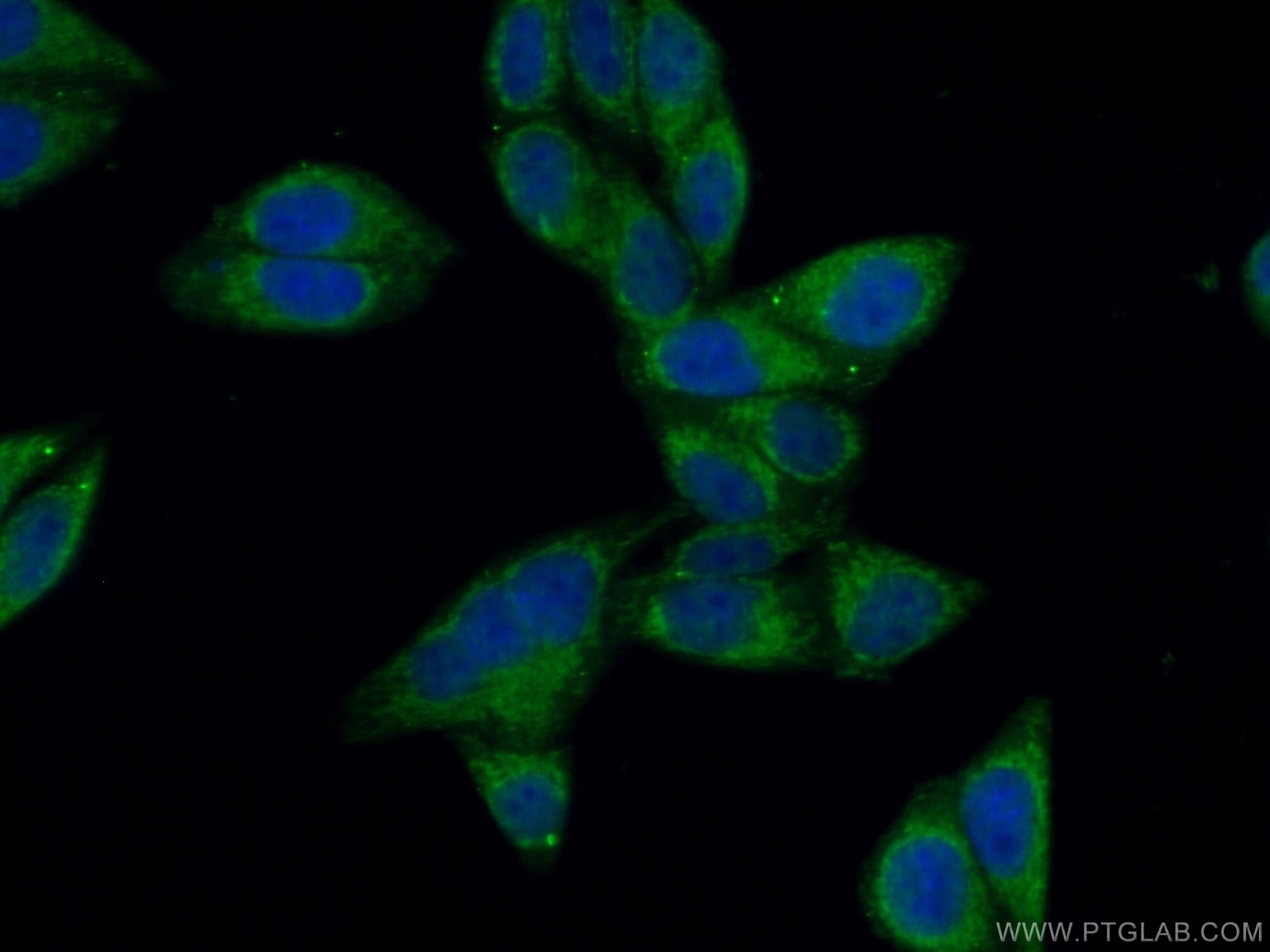 Immunofluorescence (IF) / fluorescent staining of HepG2 cells using NPC1 Polyclonal antibody (13926-1-AP)