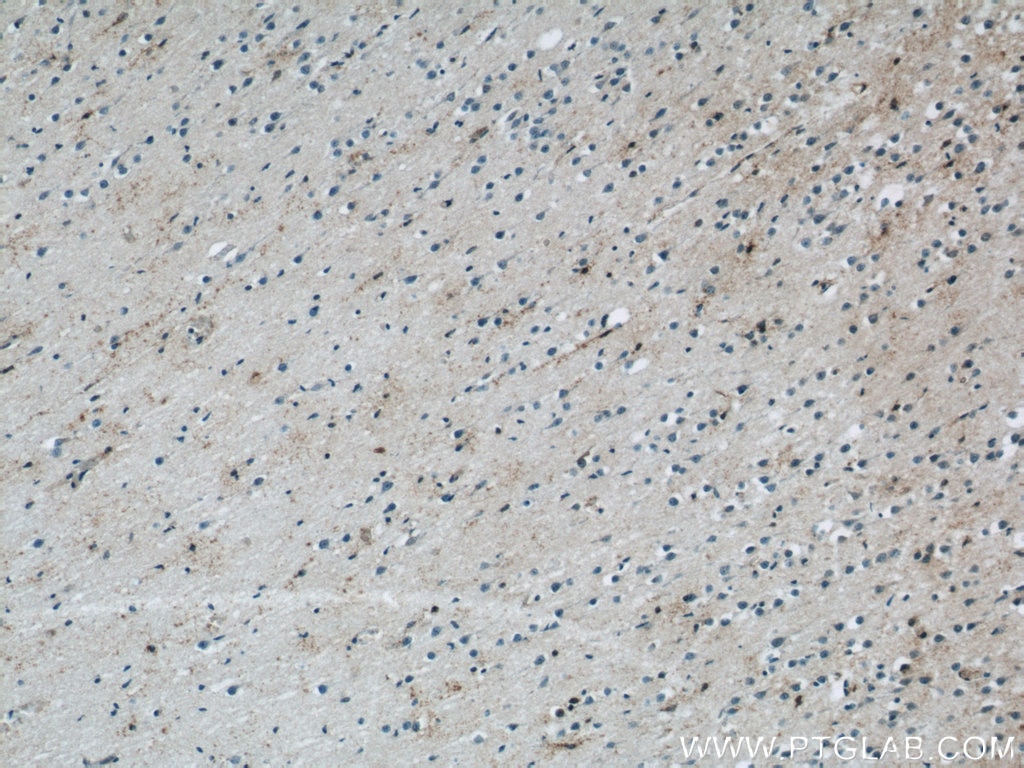 Immunohistochemistry (IHC) staining of human brain tissue using NPC1 Polyclonal antibody (13926-1-AP)