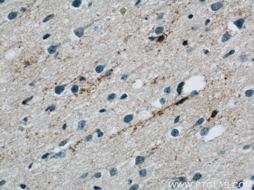 Immunohistochemistry (IHC) staining of human brain tissue using NPC1 Polyclonal antibody (13926-1-AP)