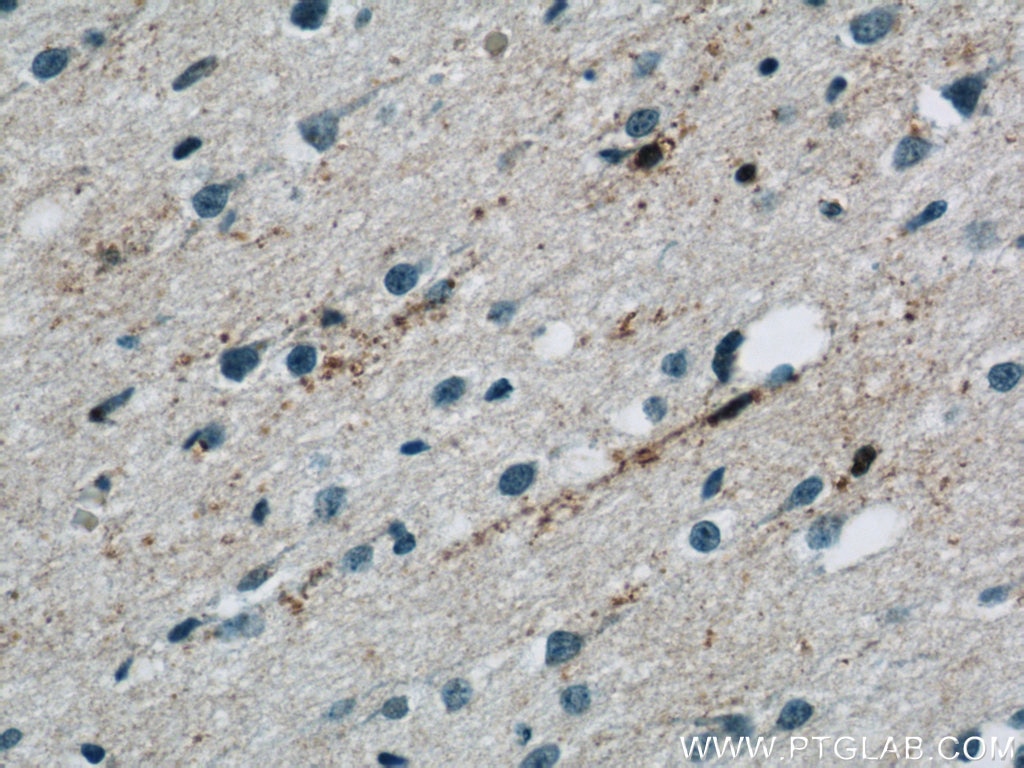 IHC staining of human brain using 13926-1-AP