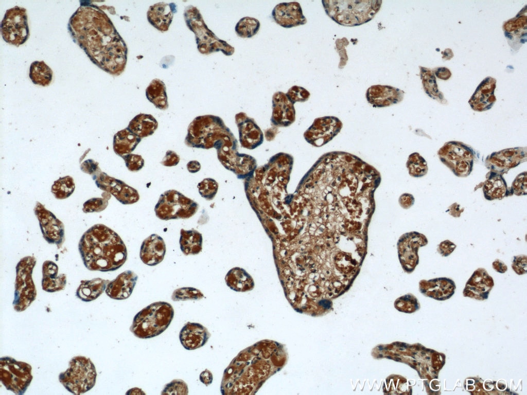 IHC staining of human placenta using 13926-1-AP