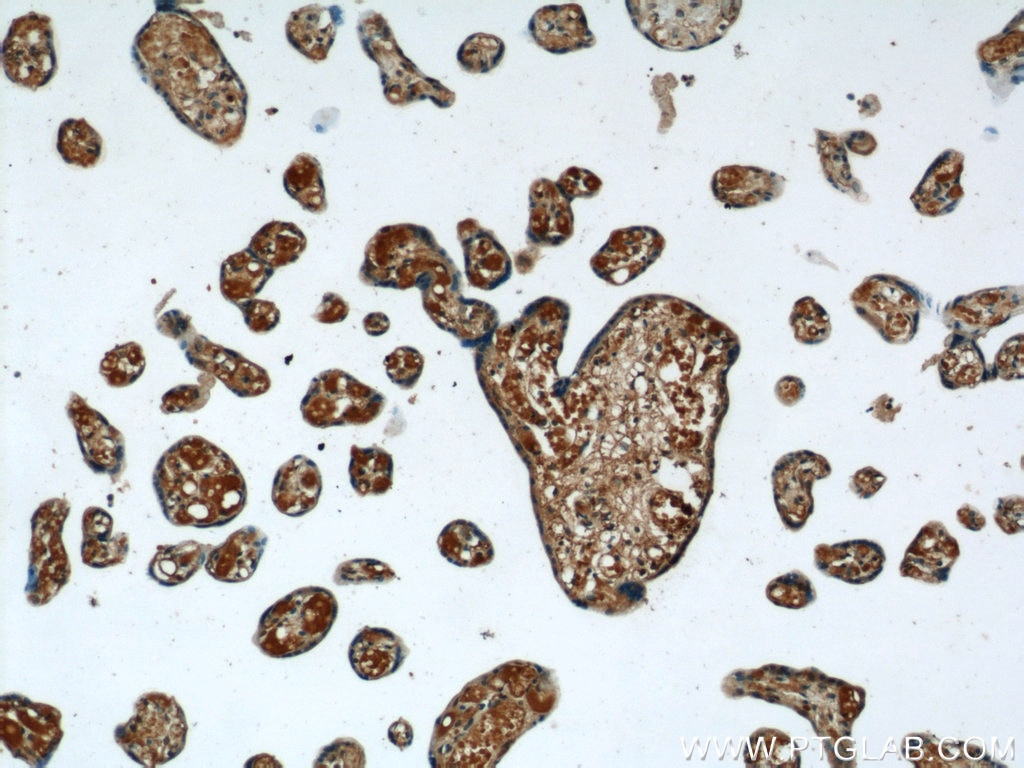 Immunohistochemistry (IHC) staining of human placenta tissue using NPC1 Polyclonal antibody (13926-1-AP)