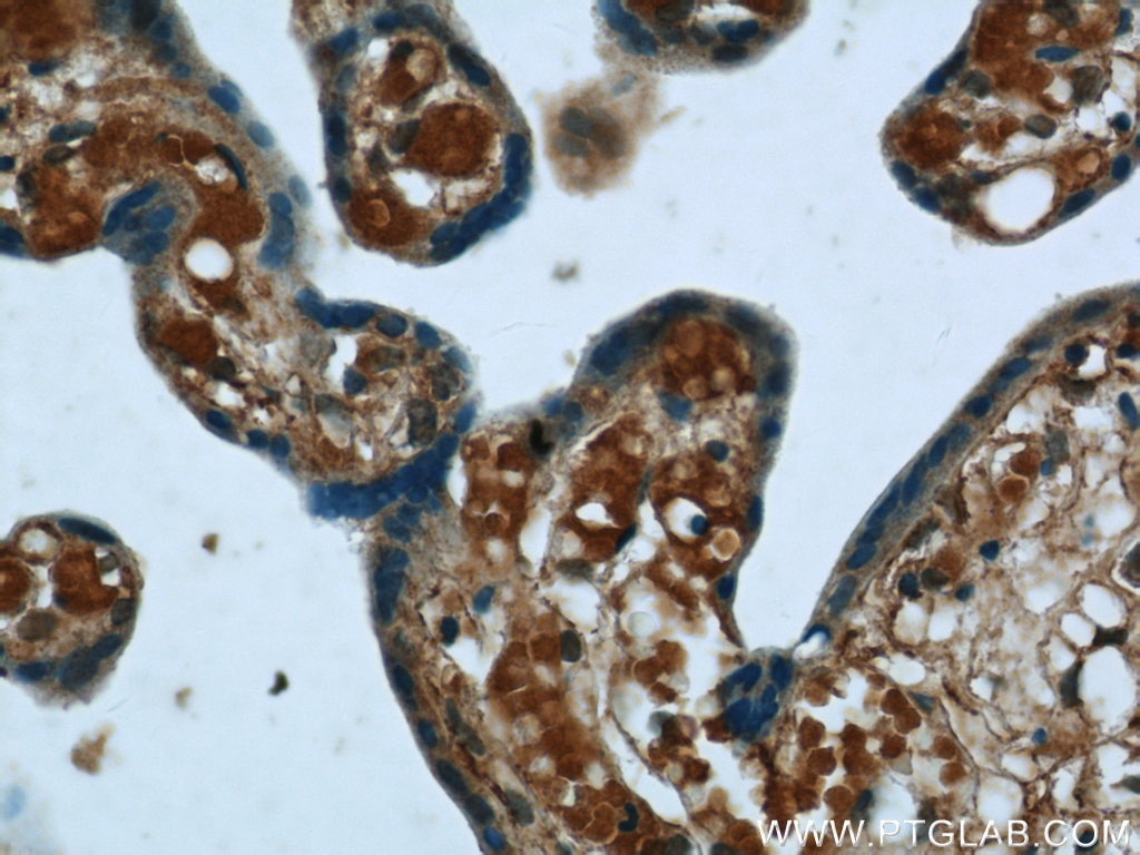 Immunohistochemistry (IHC) staining of human placenta tissue using NPC1 Polyclonal antibody (13926-1-AP)