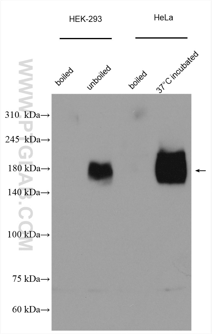 Western Blot (WB) analysis of various lysates using NPC1 Polyclonal antibody (13926-1-AP)