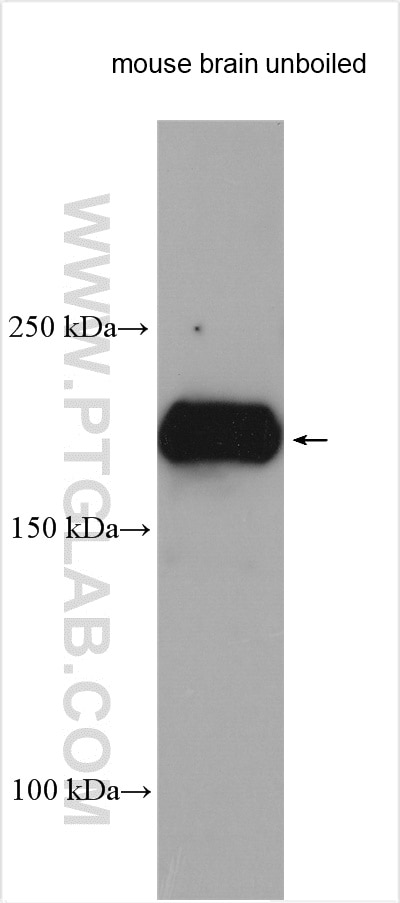 Western Blot (WB) analysis of various lysates using NPC1 Polyclonal antibody (13926-1-AP)