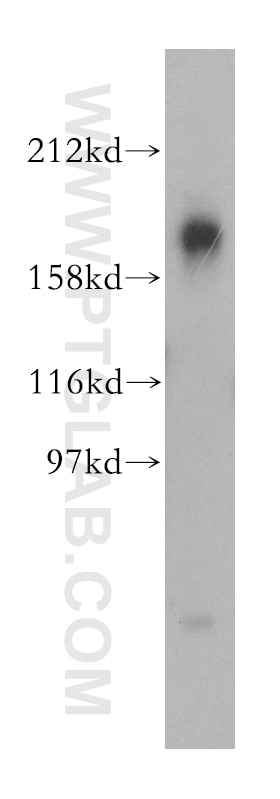 Western Blot (WB) analysis of HepG2 cells using NPC1 Polyclonal antibody (13926-1-AP)