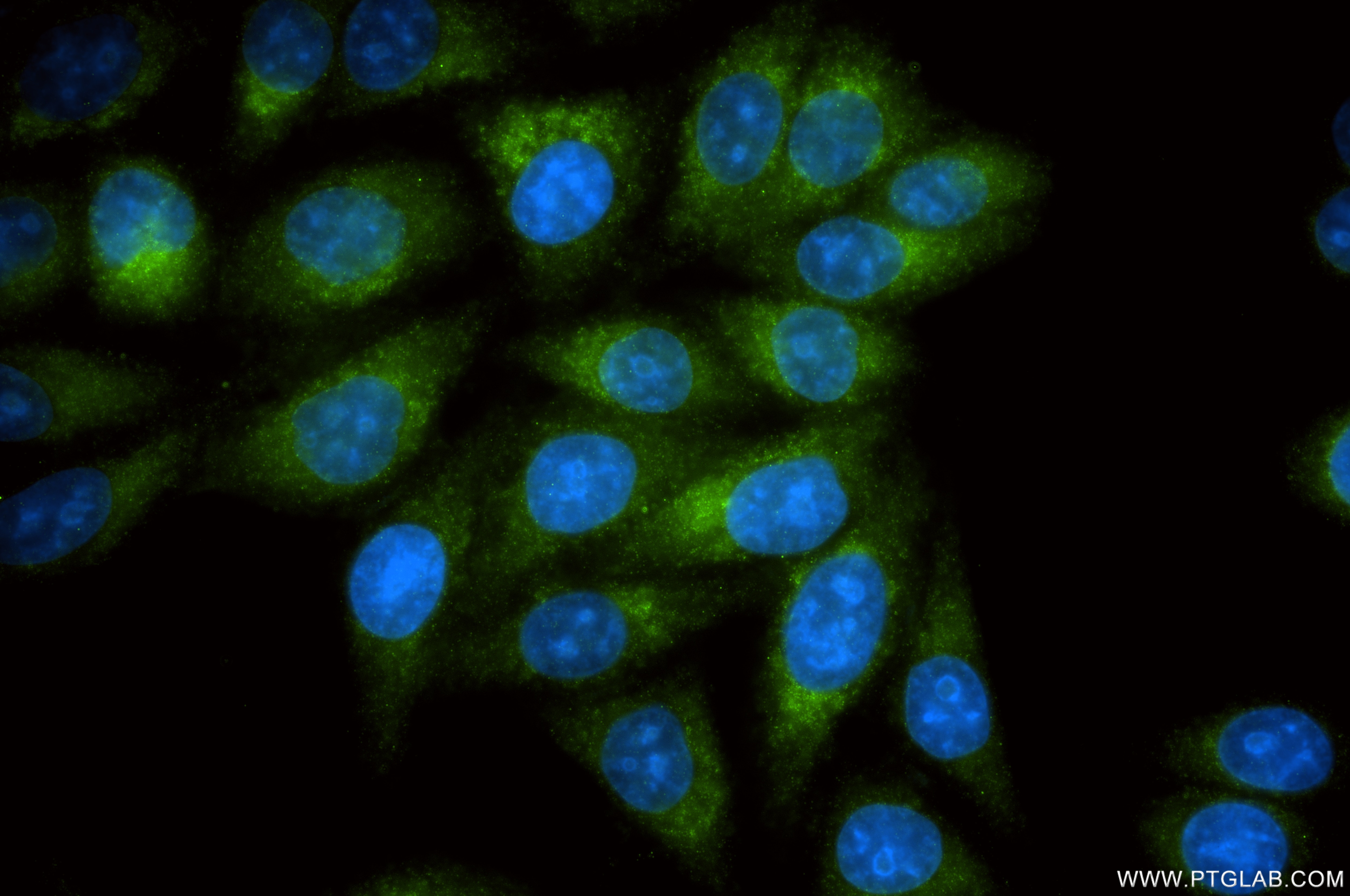 Immunofluorescence (IF) / fluorescent staining of HepG2 cells using NPC1 Recombinant monoclonal antibody (86233-5-RR)