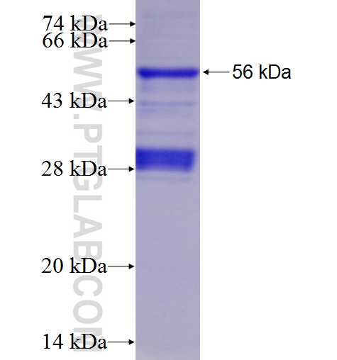 NPC1 fusion protein Ag4946 SDS-PAGE