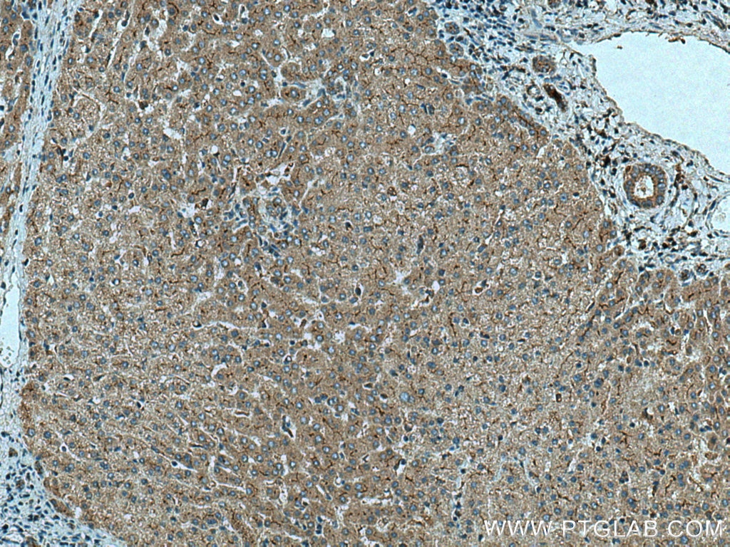 Immunohistochemistry (IHC) staining of human liver tissue using NPC1L1 Polyclonal antibody (28085-1-AP)