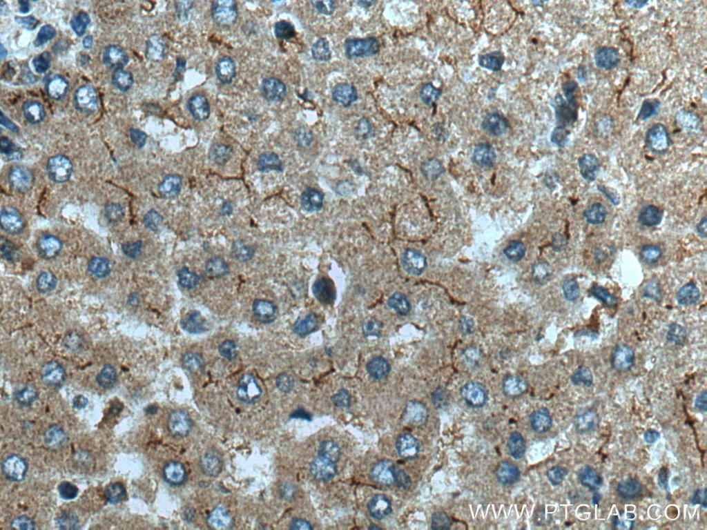 Immunohistochemistry (IHC) staining of human liver tissue using NPC1L1 Polyclonal antibody (28085-1-AP)