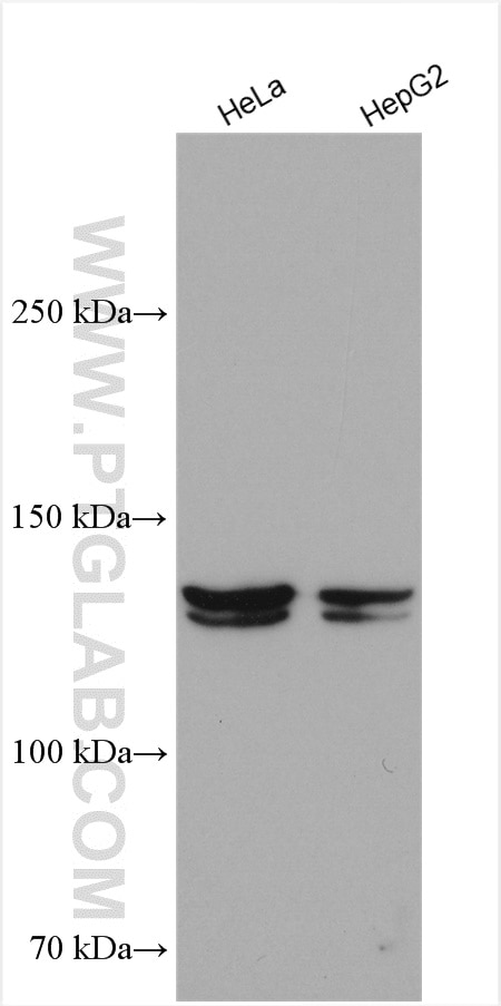 Western Blot (WB) analysis of various lysates using NPC1L1 Polyclonal antibody (28085-1-AP)