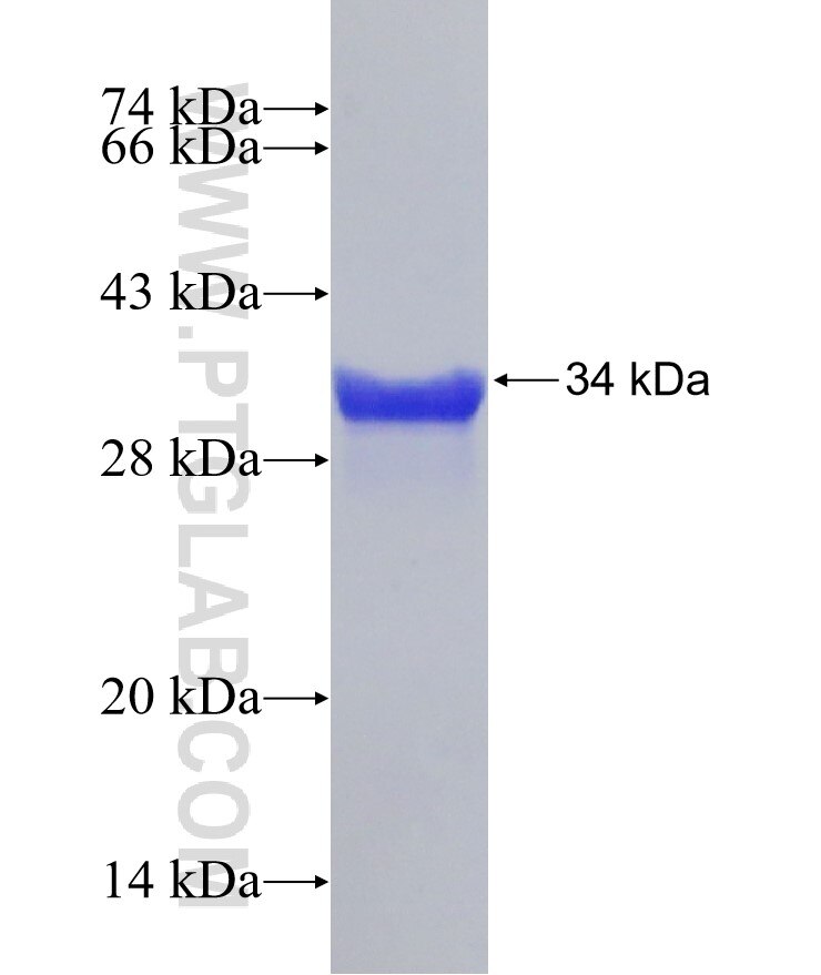 NPC1L1 fusion protein Ag26277 SDS-PAGE