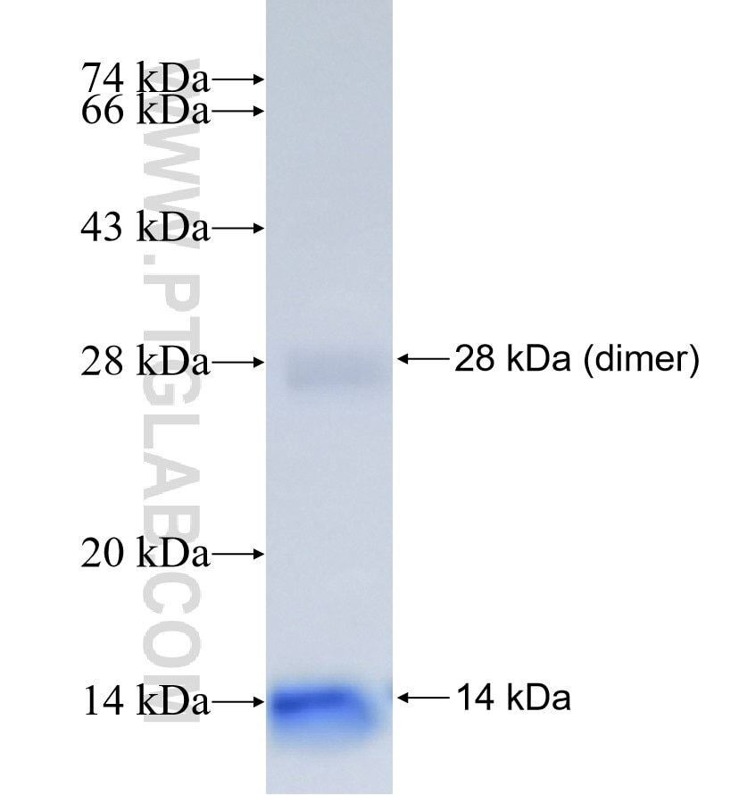 NPC1L1 fusion protein Ag26293 SDS-PAGE