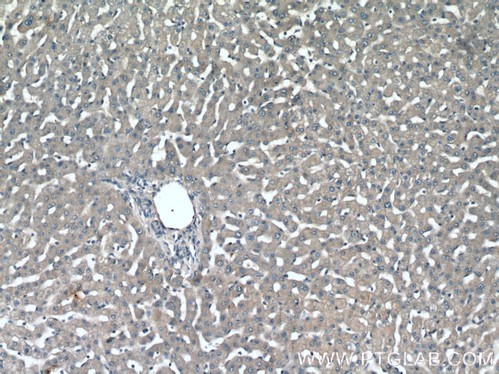 Immunohistochemistry (IHC) staining of human liver tissue using NPC2 Polyclonal antibody (19888-1-AP)