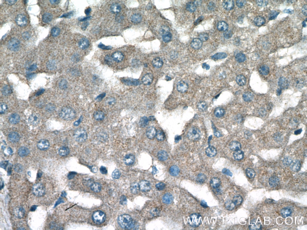 Immunohistochemistry (IHC) staining of human liver tissue using NPC2 Polyclonal antibody (19888-1-AP)