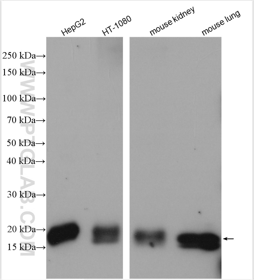Western Blot (WB) analysis of various lysates using NPC2 Polyclonal antibody (19888-1-AP)