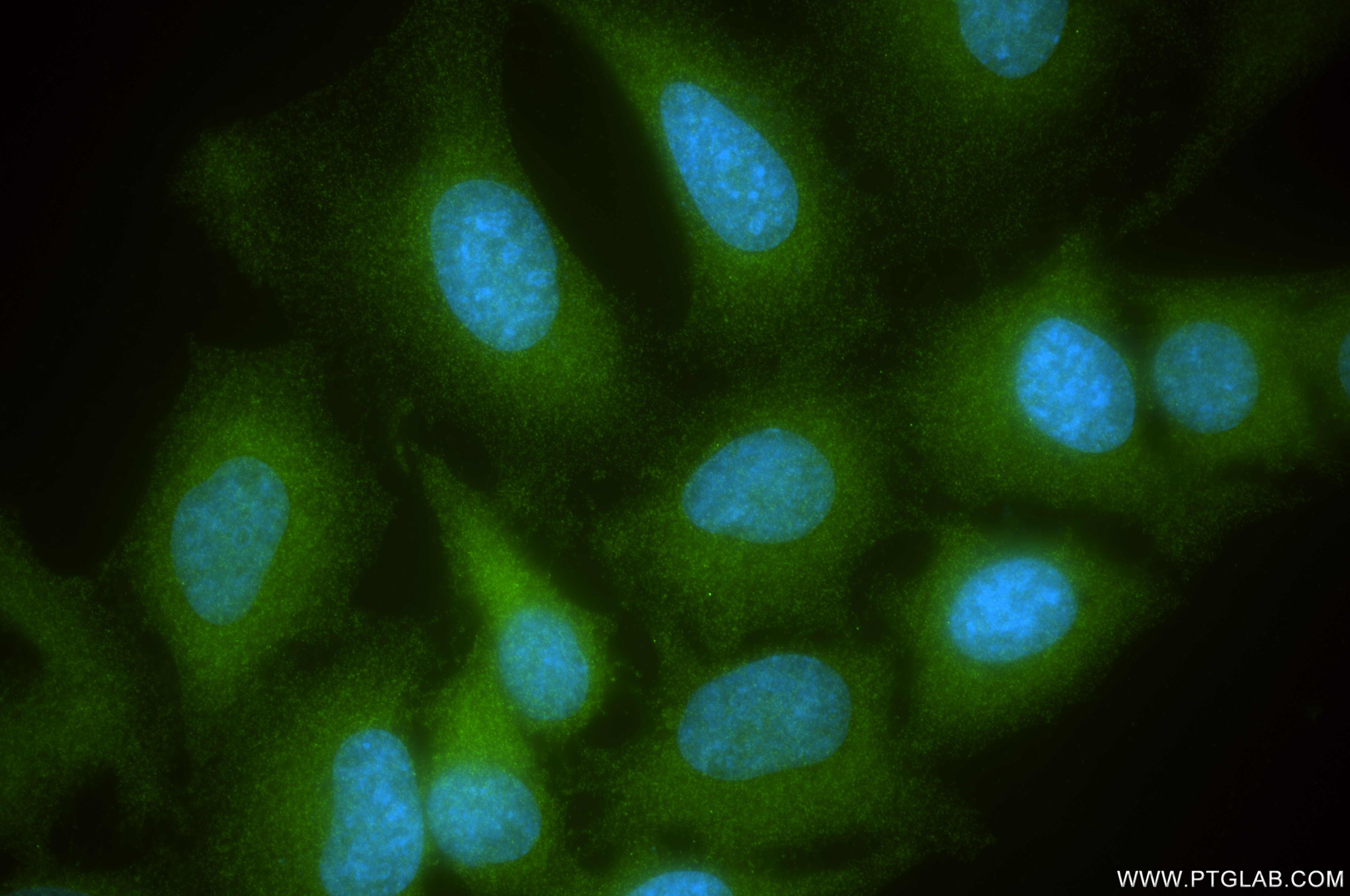 Immunofluorescence (IF) / fluorescent staining of HeLa cells using NPC2 Recombinant antibody (86293-1-RR)