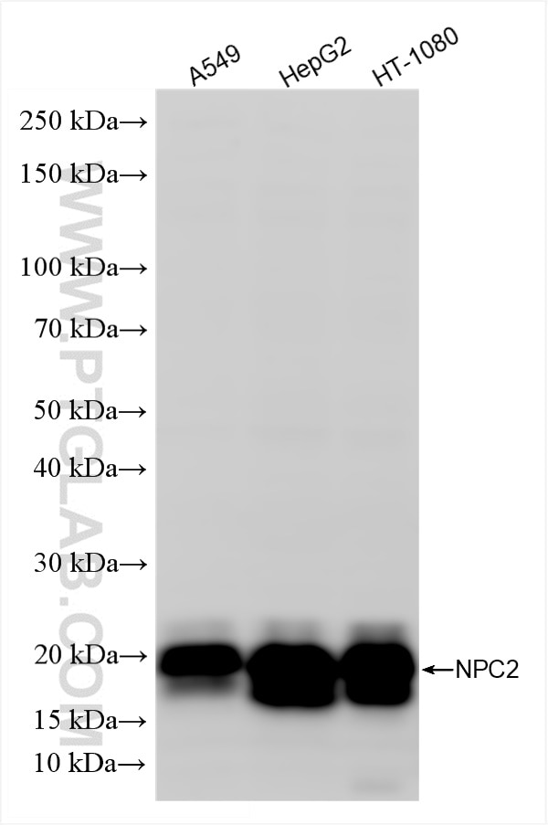 Western Blot (WB) analysis of various lysates using NPC2 Recombinant antibody (86293-1-RR)