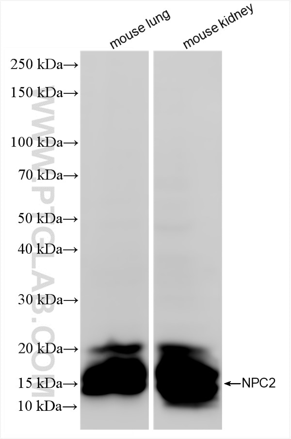 Western Blot (WB) analysis of various lysates using NPC2 Recombinant antibody (86293-1-RR)