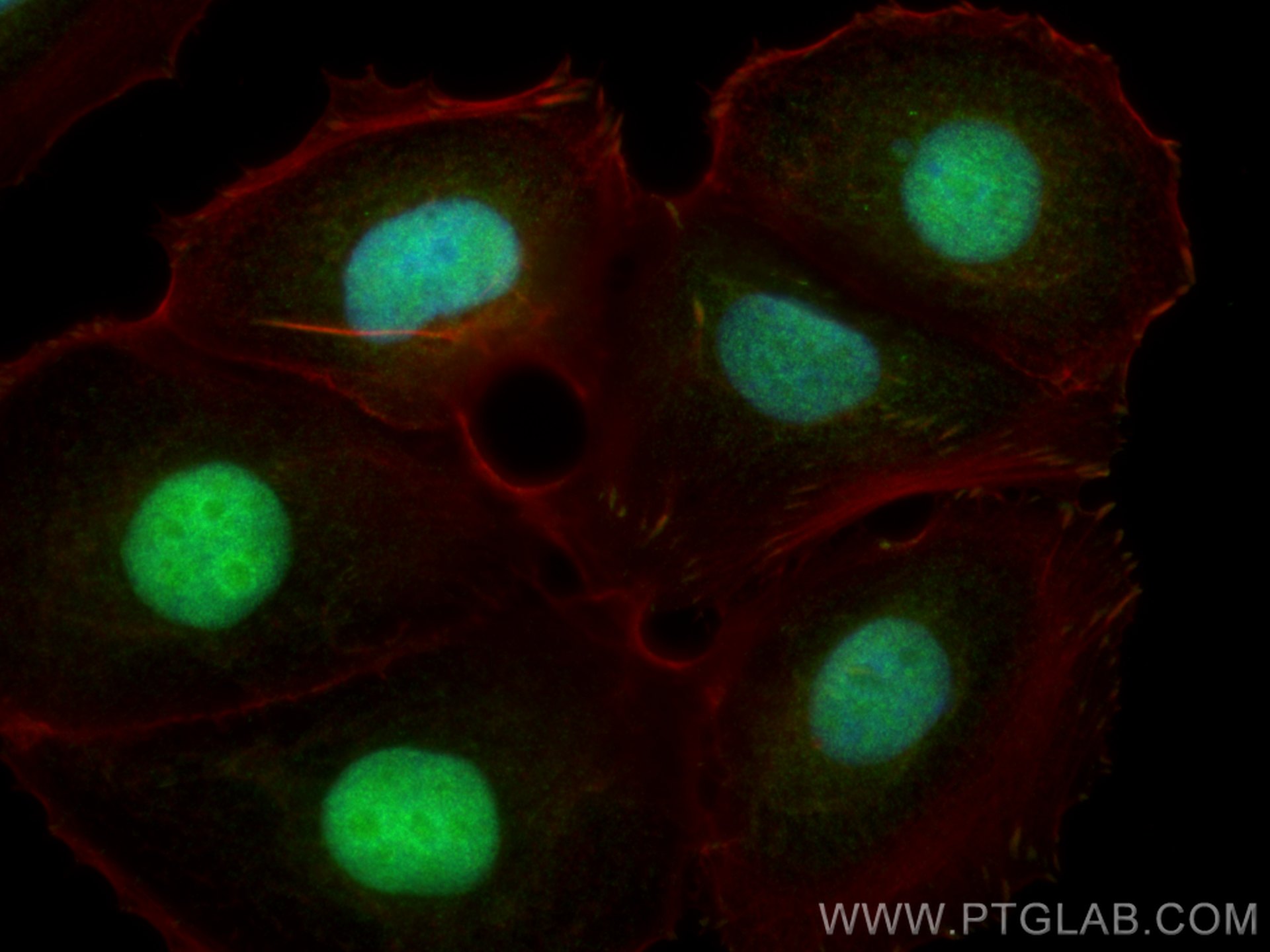 Immunofluorescence (IF) / fluorescent staining of MCF-7 cells using NPEPL1 Polyclonal antibody (17211-1-AP)