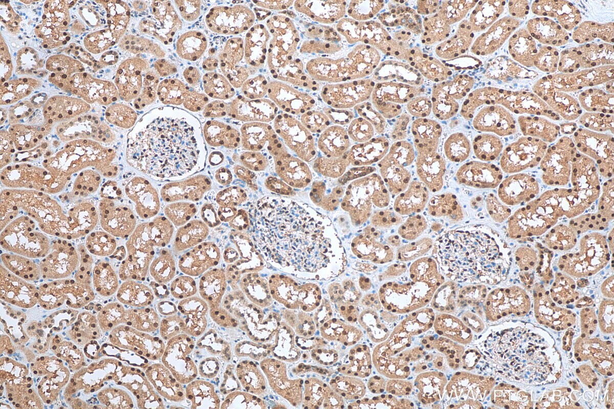 IHC staining of human kidney using 17211-1-AP