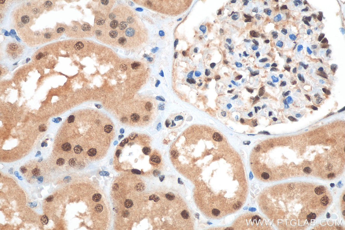 Immunohistochemistry (IHC) staining of human kidney tissue using NPEPL1 Polyclonal antibody (17211-1-AP)