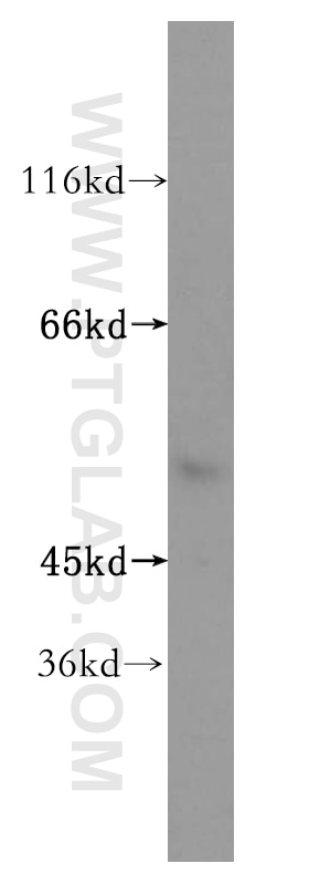 Western Blot (WB) analysis of HeLa cells using NPEPL1 Polyclonal antibody (17211-1-AP)