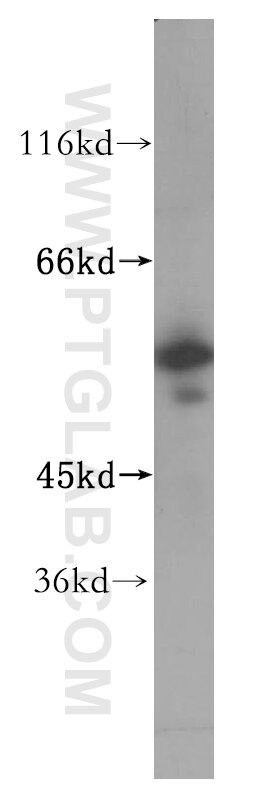 Western Blot (WB) analysis of MCF-7 cells using NPEPL1 Polyclonal antibody (17211-1-AP)