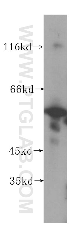 Western Blot (WB) analysis of HeLa cells using NPEPL1 Polyclonal antibody (17211-1-AP)