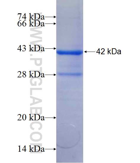 NPEPL1 fusion protein Ag11683 SDS-PAGE