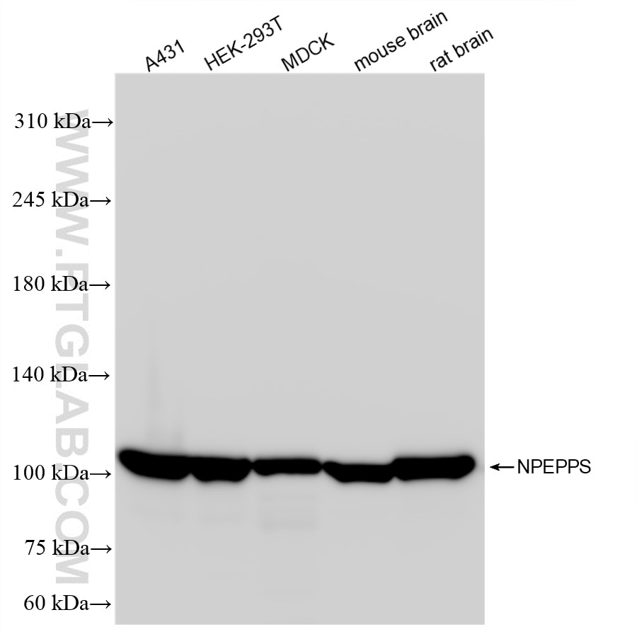 Western Blot (WB) analysis of various lysates using NPEPPS Recombinant antibody (84230-2-RR)