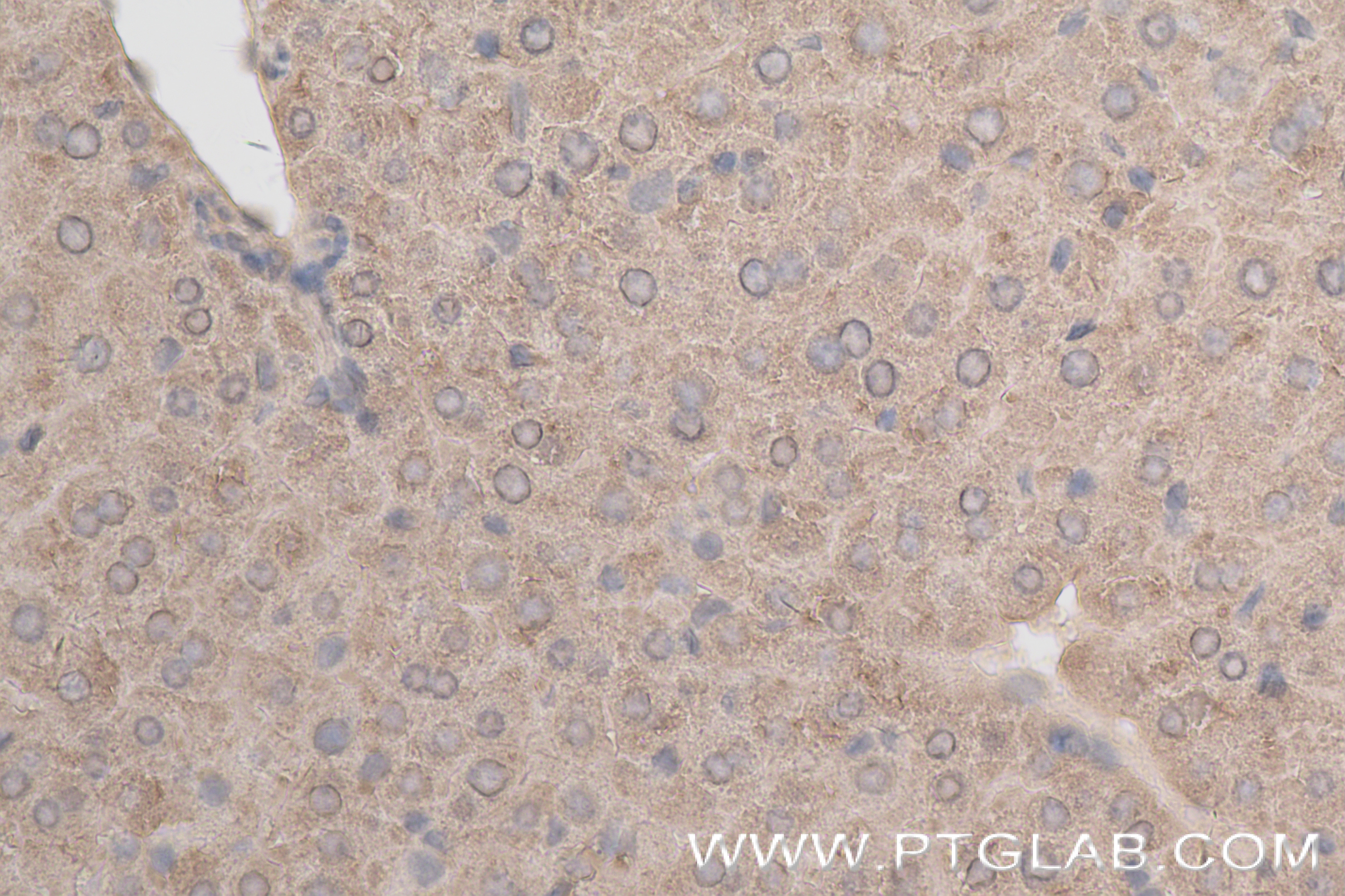 Immunohistochemistry (IHC) staining of mouse liver tissue using NPEPPS Recombinant antibody (84230-4-RR)