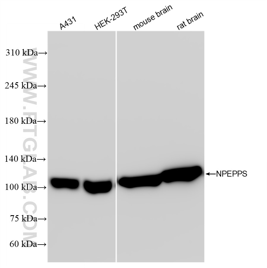 Western Blot (WB) analysis of various lysates using NPEPPS Recombinant antibody (84230-4-RR)