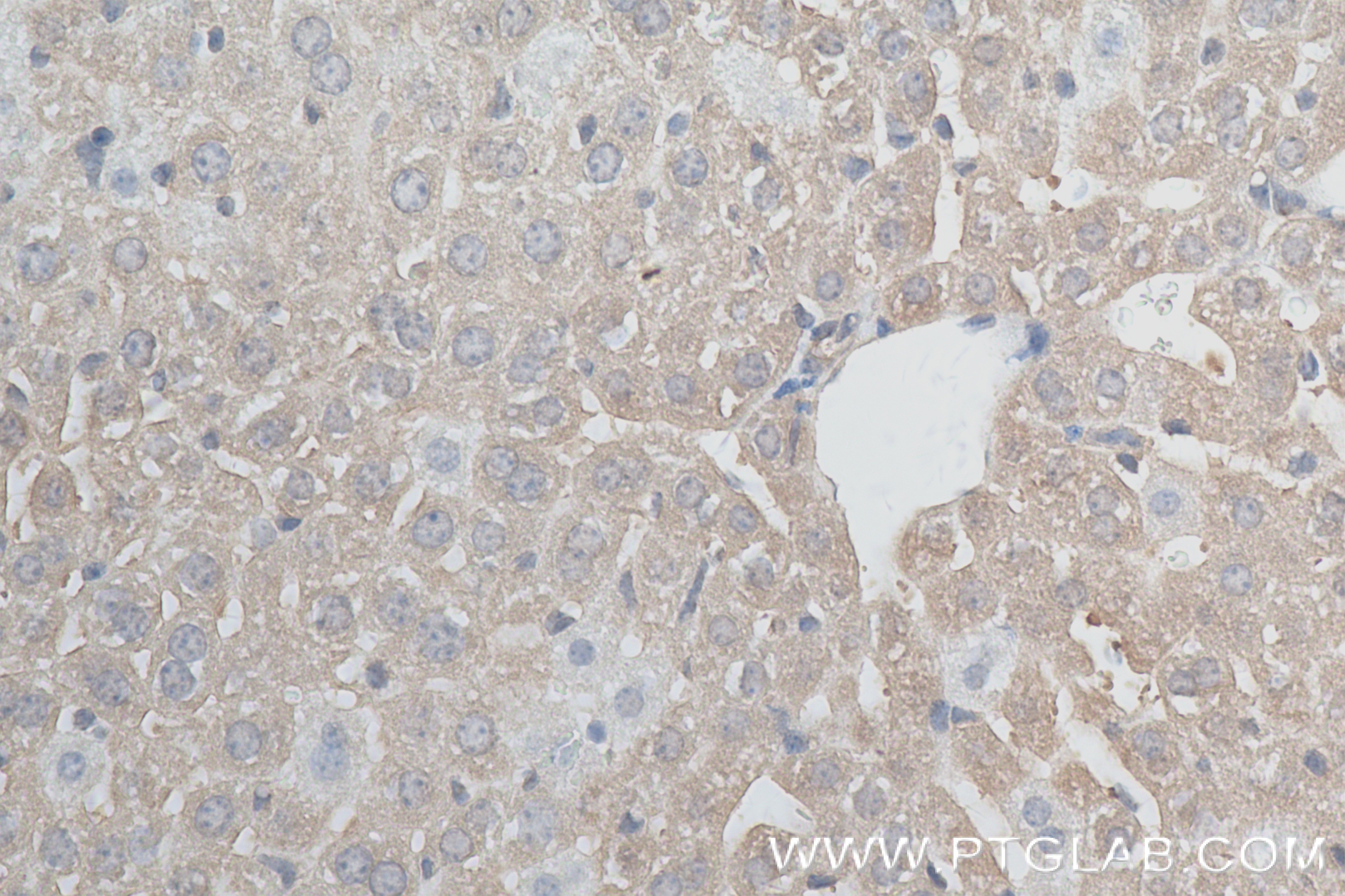 Immunohistochemistry (IHC) staining of mouse liver tissue using NPEPPS Recombinant antibody (84230-5-RR)