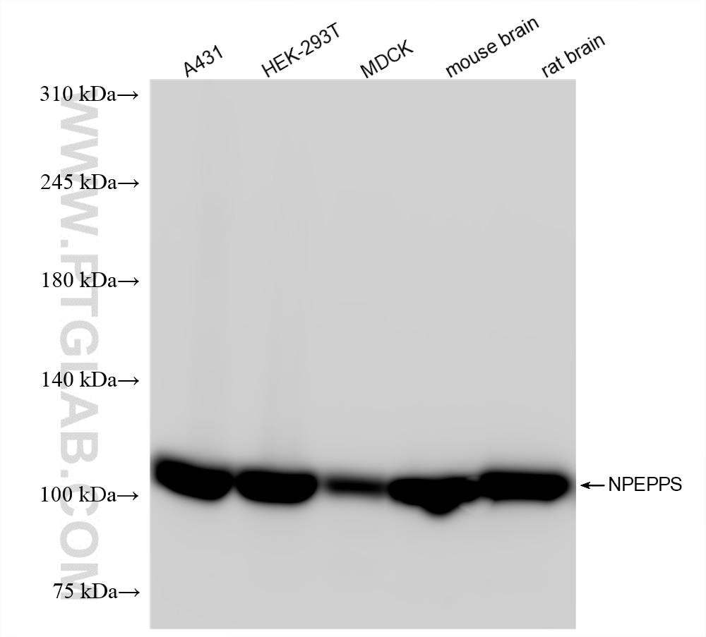Western Blot (WB) analysis of various lysates using NPEPPS Recombinant antibody (84230-5-RR)