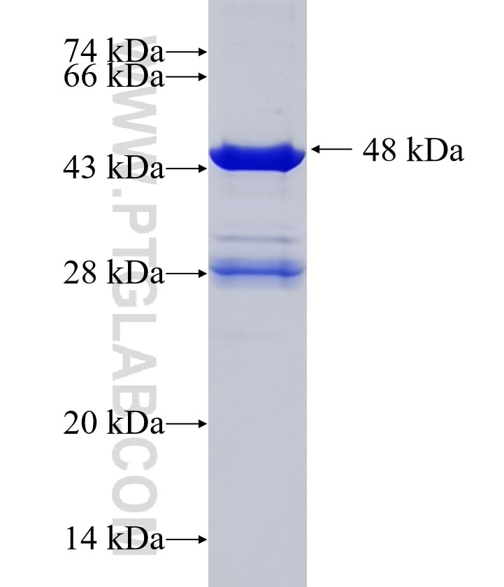 NPEPPS fusion protein Ag36035 SDS-PAGE