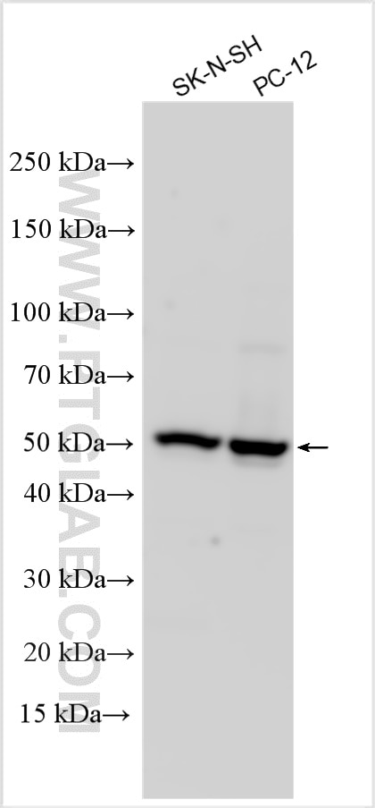 Western Blot (WB) analysis of various lysates using NPFFR1 Polyclonal antibody (23415-1-AP)