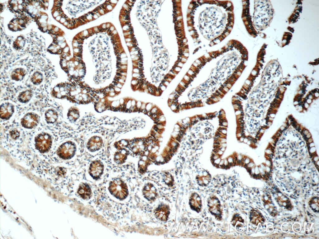 Immunohistochemistry (IHC) staining of human small intestine tissue using NPFFR2 Polyclonal antibody (19505-1-AP)