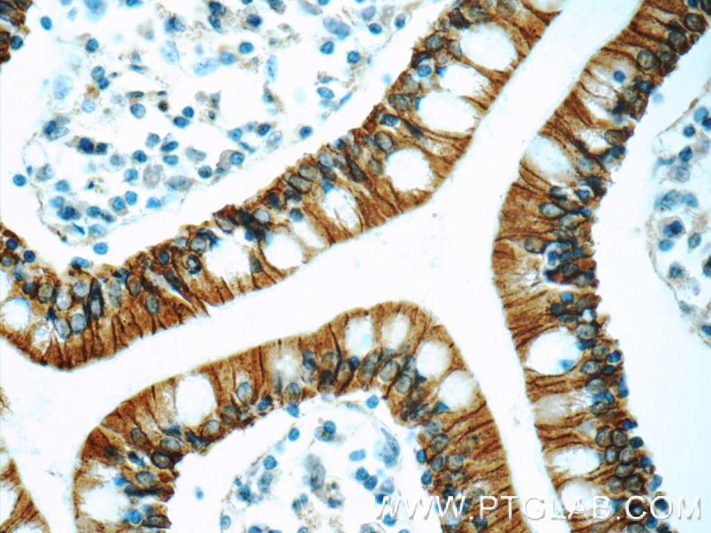 Immunohistochemistry (IHC) staining of human small intestine tissue using NPFFR2 Polyclonal antibody (19505-1-AP)